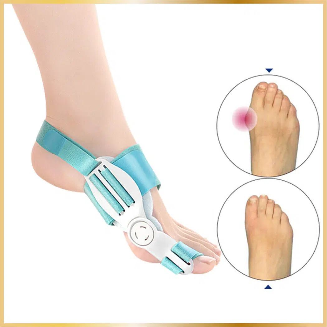 Advanced hallux valgus bunion aid splint - FeetiFix
